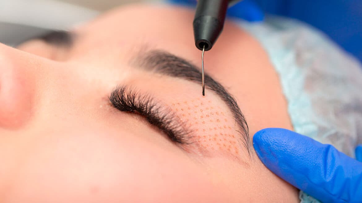 Plasma Pen Technician training at BC Medical Spa & Wellness Centre